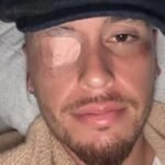 El ex del Sevilla FC Lucas Ocampos sufre una parálisis facial