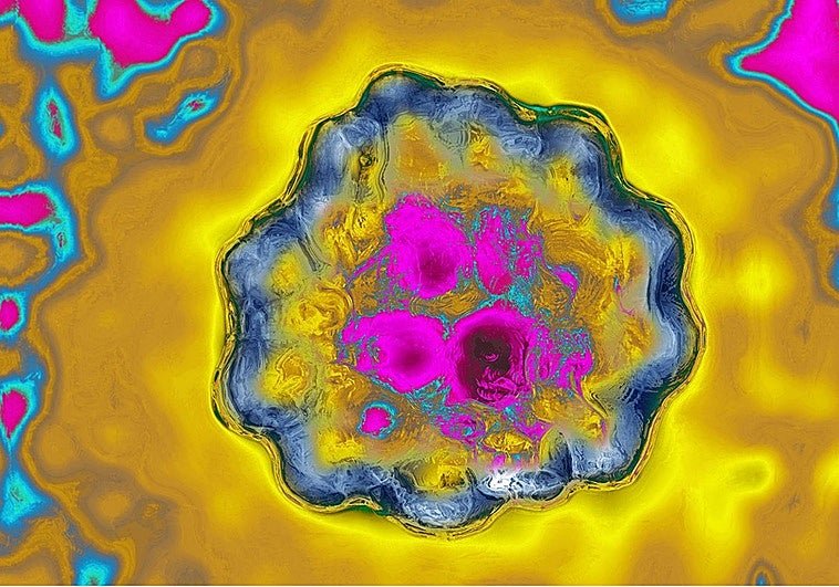 La hepatitis D hace historia: su genoma es el primer virus cargado en un ordenador cuántico