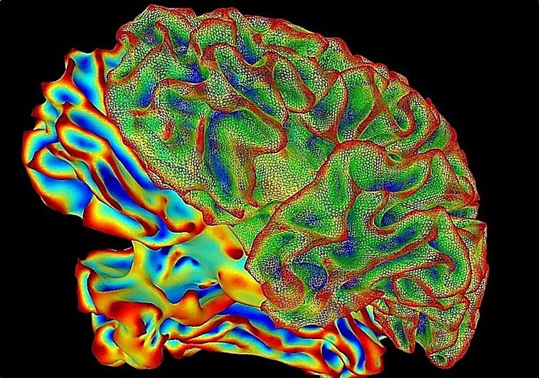 Logran poner a la muerte ‘en pausa’ y congelar intacto un cerebro para reactivarlo en el futuro