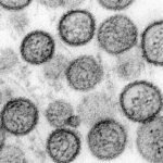 La primera secuenciación del hantavirus del MV Hondius apunta a que no ha mutado