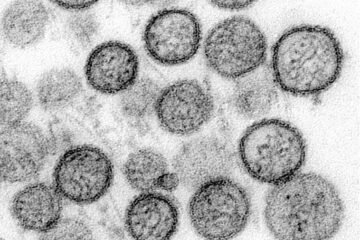 La primera secuenciación del hantavirus del MV Hondius apunta a que no ha mutado