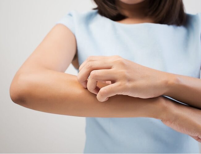 ¿Por qué a unas personas les pican más los mosquitos que a otras? Un médico desmonta el mito de la sangre dulce