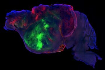 Científicos injertan neuronas humanas en ratones sin corteza cerebral y recuperan sus capacidades